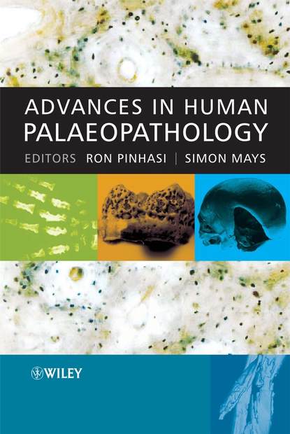 Скачать книгу Advances in Human Palaeopathology