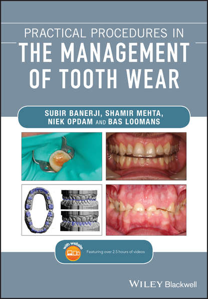 Скачать книгу Practical Procedures in the Management of Tooth Wear