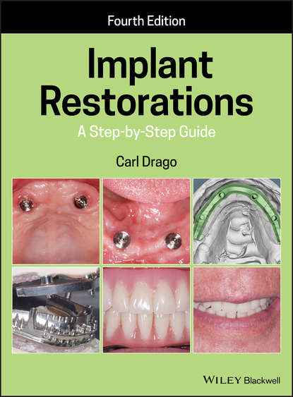 Скачать книгу Implant Restorations