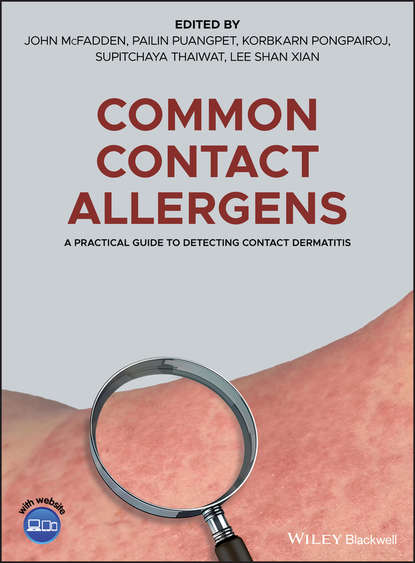 Скачать книгу Common Contact Allergens