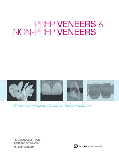 Скачать книгу Prep Veneers und Non-Prep Veneers