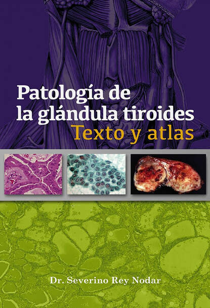 Скачать книгу Patología de la glándula tiroides