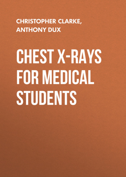 Скачать книгу Chest X-Rays for Medical Students