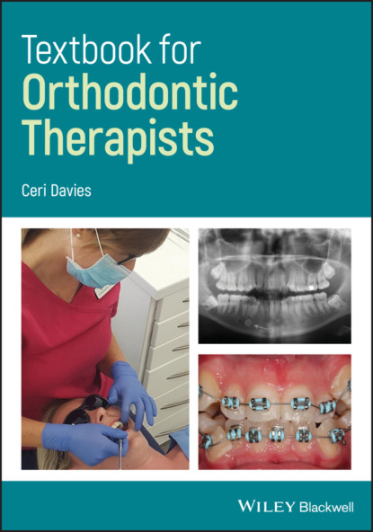 Скачать книгу Textbook for Orthodontic Therapists