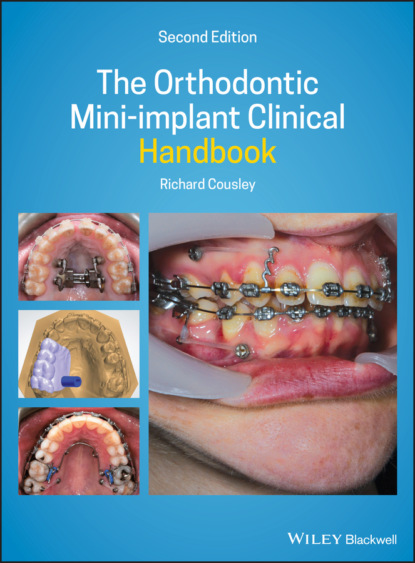 Скачать книгу The Orthodontic Mini-implant Clinical Handbook