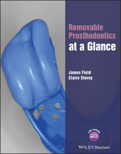 Скачать книгу Removable Prosthodontics at a Glance