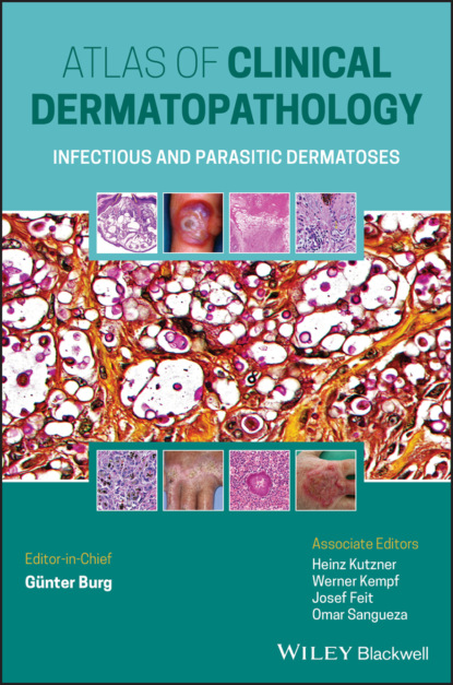 Скачать книгу Atlas of Clinical Dermatopathology