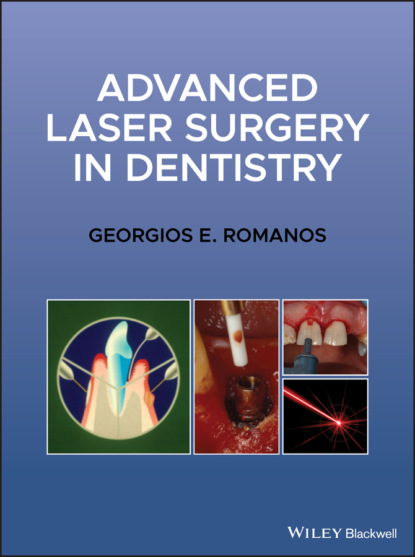 Скачать книгу Advanced Laser Surgery in Dentistry