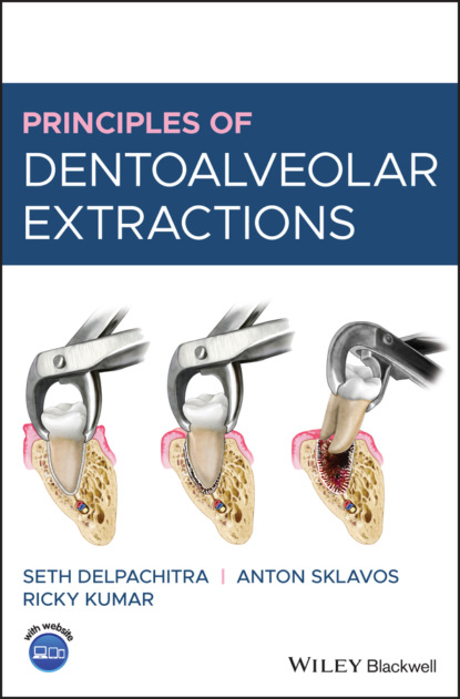 Скачать книгу Principles of Dentoalveolar Extractions