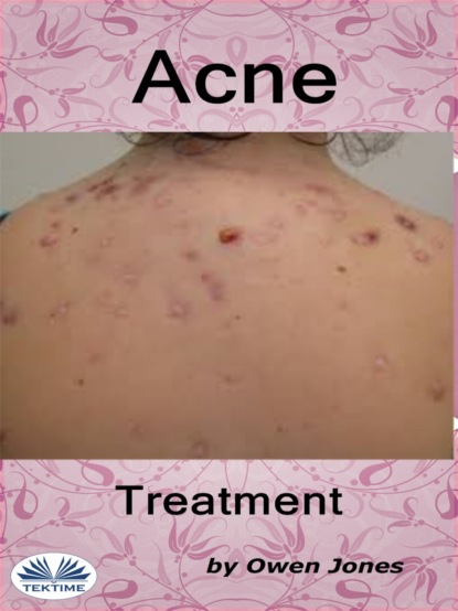 Скачать книгу Acne Treatment