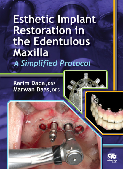 Скачать книгу Esthetic Implant Restoration in the Edentulous Maxilla