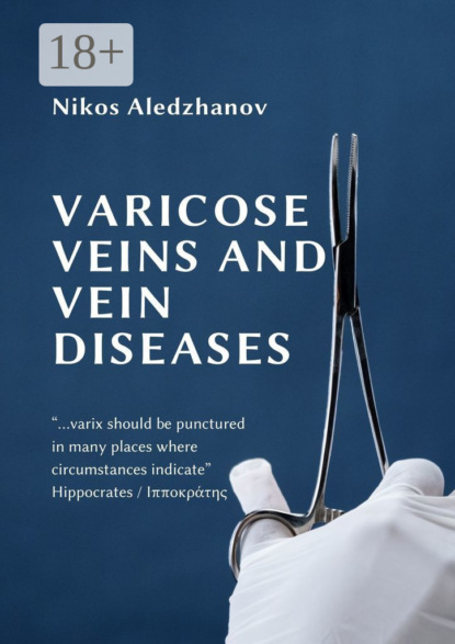 Скачать книгу VARICOSE VEINS AND VEIN DISEASES