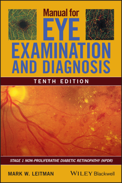 Скачать книгу Manual for Eye Examination and Diagnosis