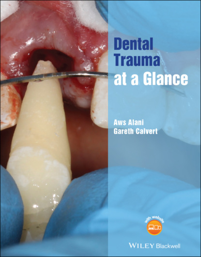 Скачать книгу Dental Trauma at a Glance