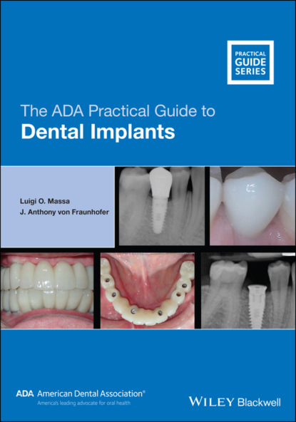Скачать книгу The ADA Practical Guide to Dental Implants
