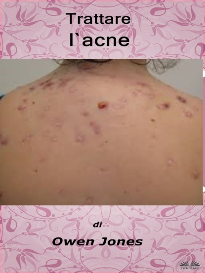 Скачать книгу Trattare L'Acne