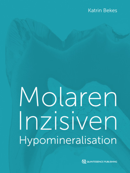 Скачать книгу Molaren-Inzisiven-Hypomineralisation