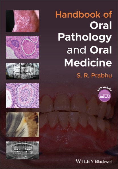 Скачать книгу Handbook of Oral Pathology and Oral Medicine