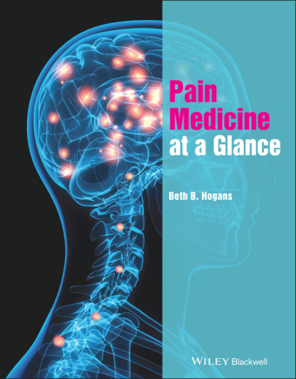 Скачать книгу Pain Medicine at a Glance