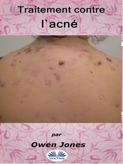 Скачать книгу Traitement Contre L'Acné