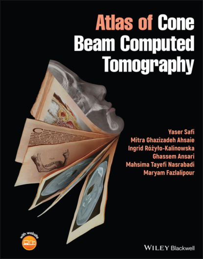 Скачать книгу Atlas of Cone Beam Computed Tomography