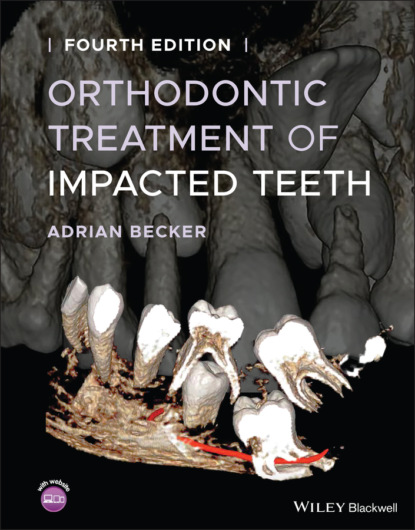 Скачать книгу Orthodontic Treatment of Impacted Teeth