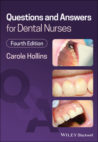 Скачать книгу Questions and Answers for Dental Nurses