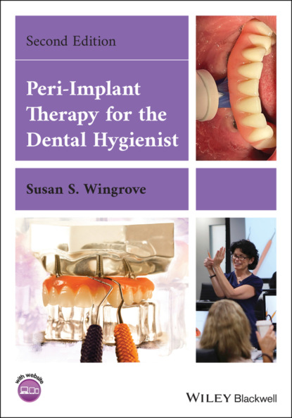 Скачать книгу Peri-Implant Therapy for the Dental Hygienist