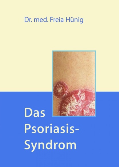 Скачать книгу Das Psoriasis-Syndrom