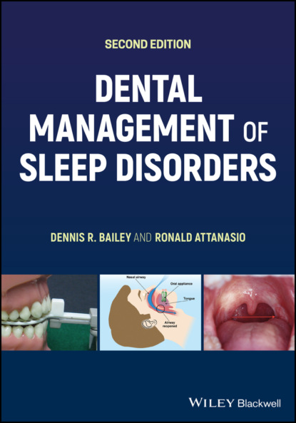 Скачать книгу Dental Management of Sleep Disorders