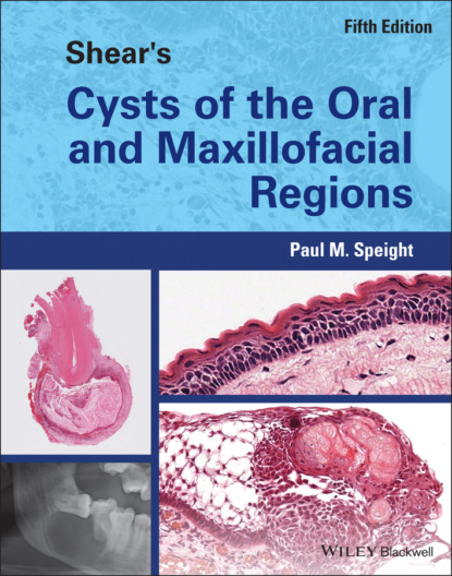 Скачать книгу Shear's Cysts of the Oral and Maxillofacial Regions