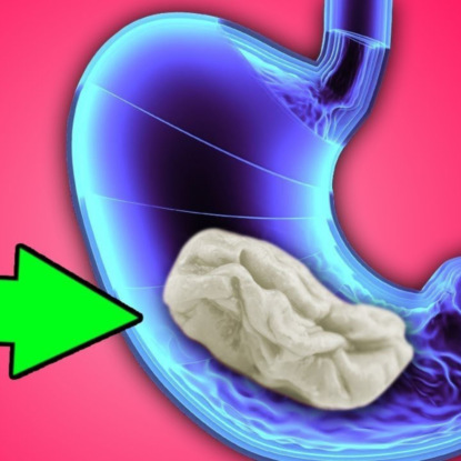 Скачать книгу FAQ: Почему нельзя глотать жвачку?