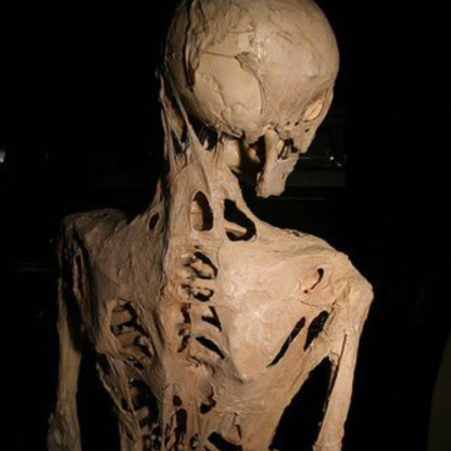 Скачать книгу FAQ: Этот редкий синдром превращает вас в камень