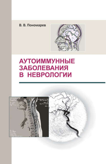 Скачать книгу Аутоиммунные заболевания в неврологии