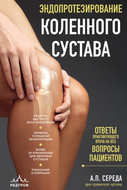 Скачать книгу Эндопротезирование коленного сустава. Ответы практикующего врача на все вопросы пациентов