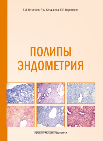 Скачать книгу Полипы эндометрия. Учебное пособие