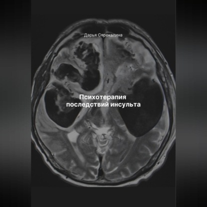 Скачать книгу Психотерапия последствий инсульта