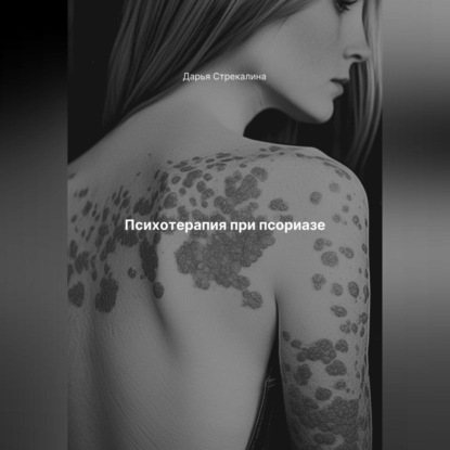 Скачать книгу Психотерапия при псориазе
