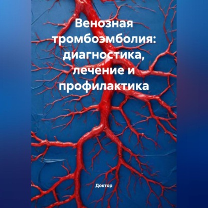 Скачать книгу Венозная тромбоэмболия: диагностика, лечение и профилактика