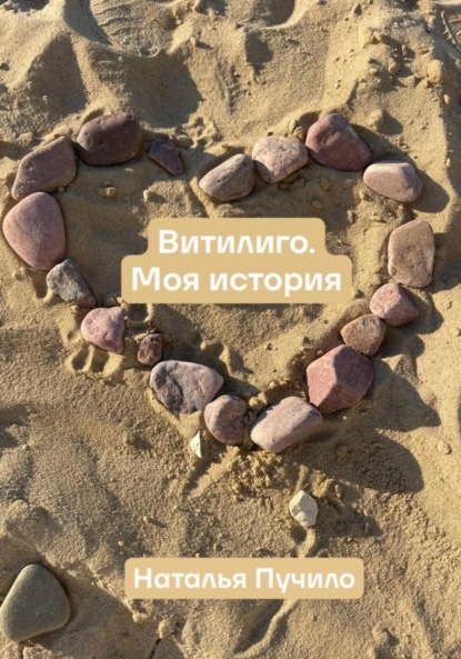 Скачать книгу Витилиго. Моя история
