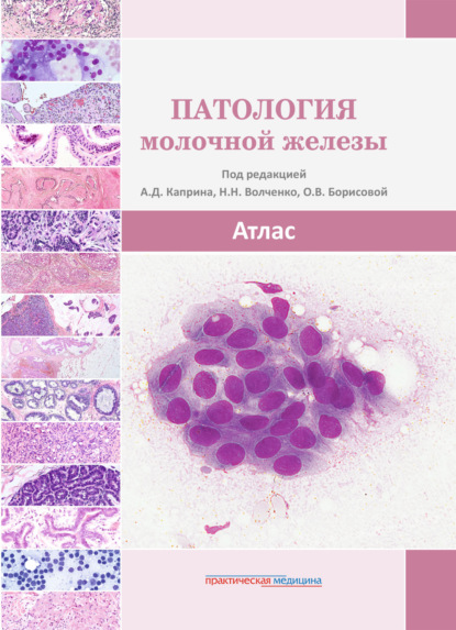 Скачать книгу Патология молочной железы. Атлас