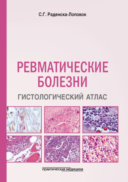 Скачать книгу Ревматические болезни. Гистологический атлас
