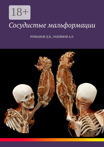 Скачать книгу Сосудистые мальформации