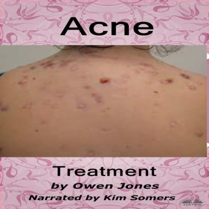 Скачать книгу Acne Treatment
