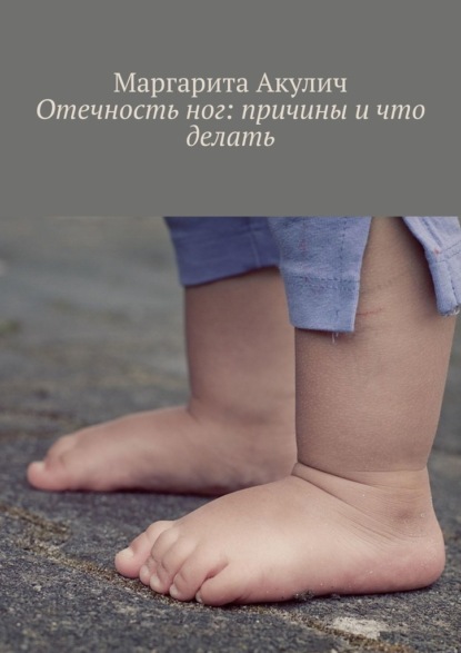 Скачать книгу Отечность ног: причины и что делать