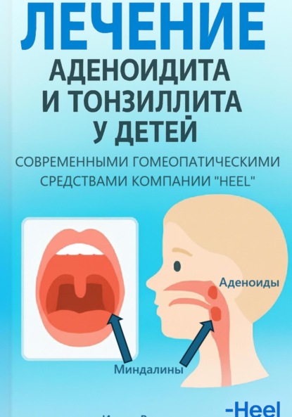 Скачать книгу Лечение аденоидита и тонзиллита у детей современными комплексными гомеопатическими препаратами фирмы «Хеель»