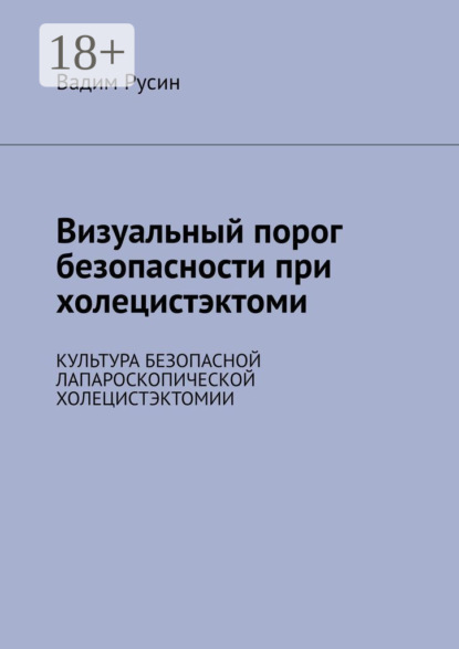 Визуальный порог безопасности при холецистэктоми. Культура безопасной лапароскопической холецистэктомии