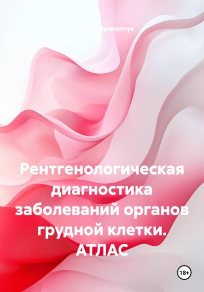 Скачать книгу Рентгенологическая диагностика заболеваний органов грудной клетки. АТЛАС