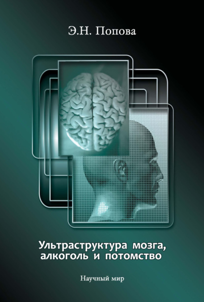 Скачать книгу Ультраструктура мозга, алкоголь и потомство