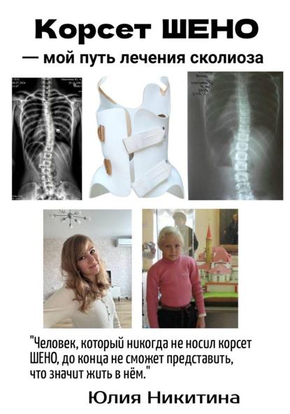 Скачать книгу Корсет Шено. Мой путь лечения сколиоза